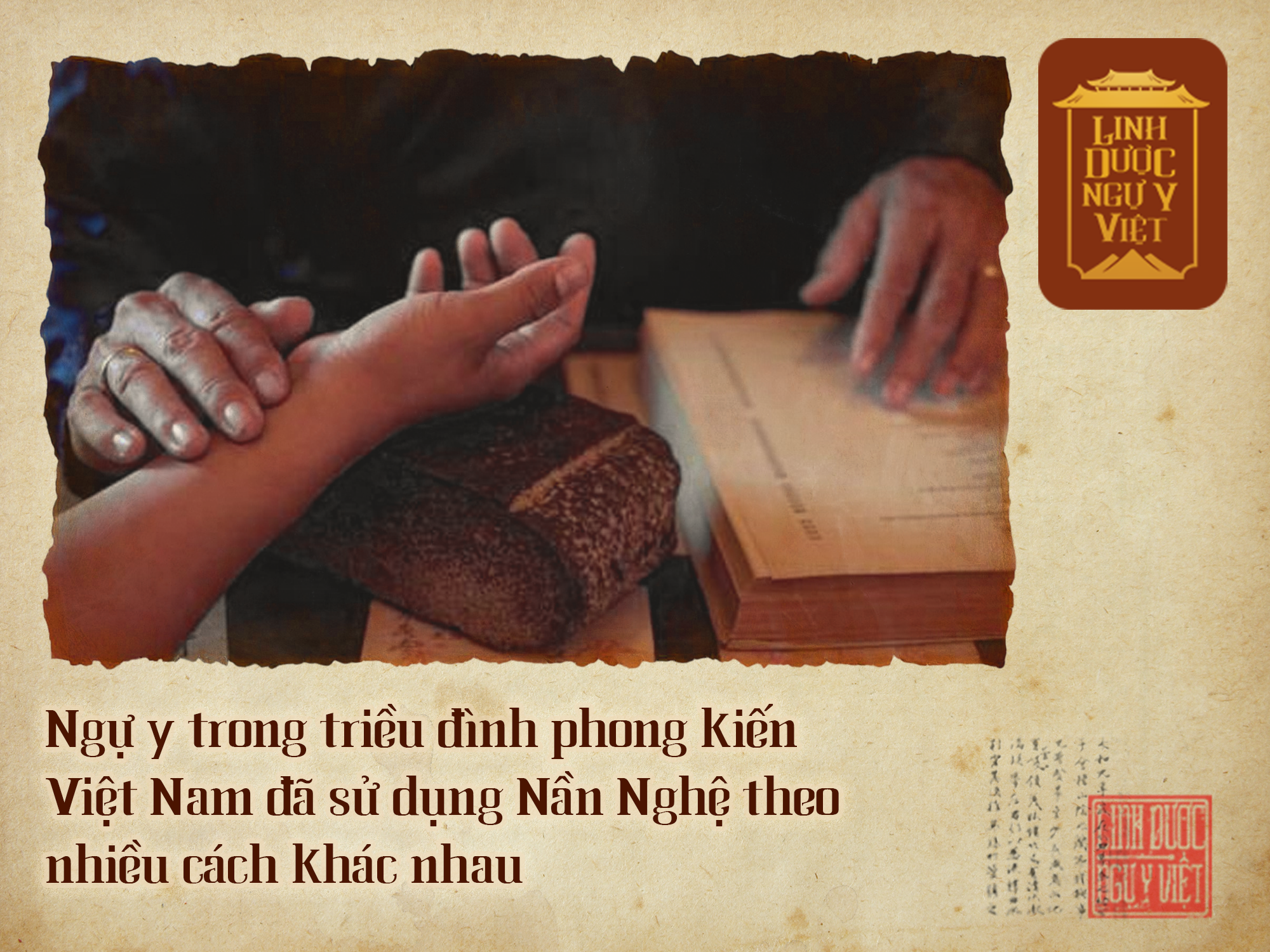 su-dung-nan-nghe-trong-cung-dinh