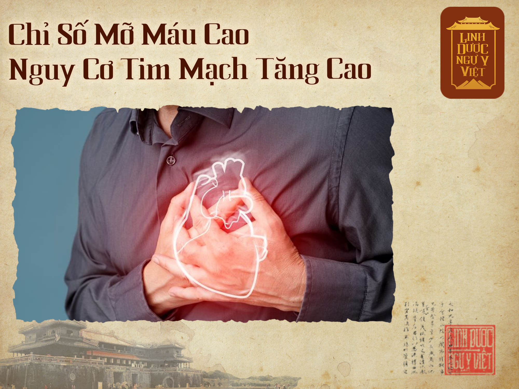 nguy-co-tim-mach-linh-duoc-ngu-y-viet