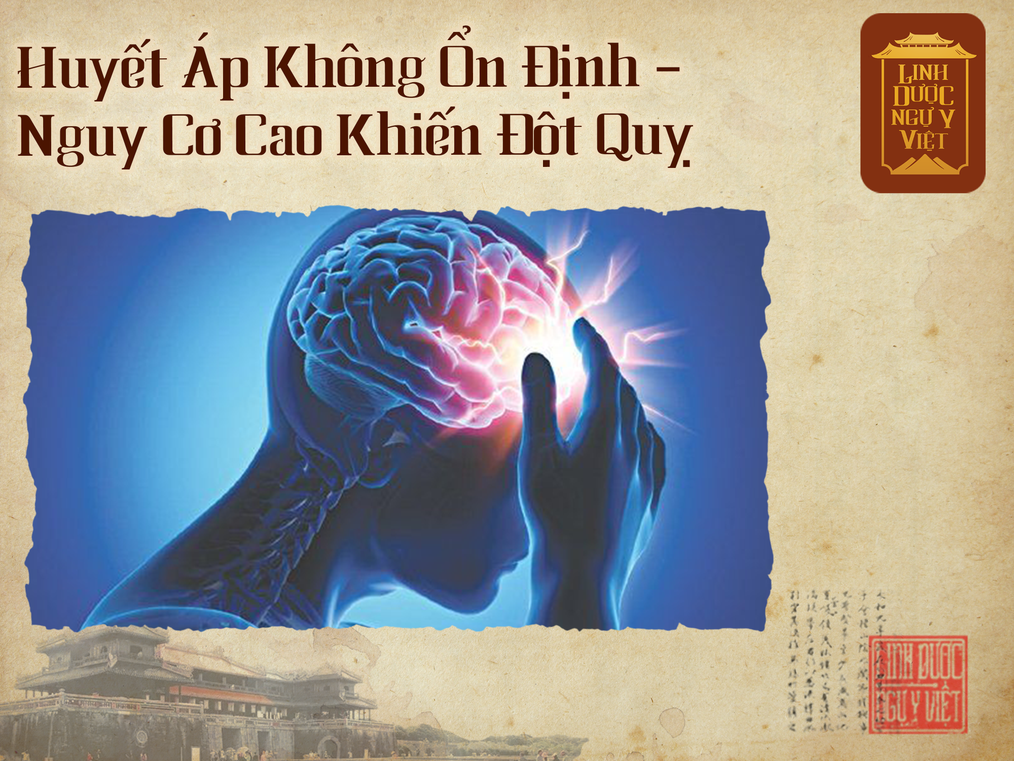 huyet-ap-khong-on-dinh